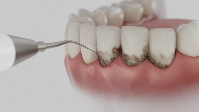 Reliable Dental Implants contractor in Ely, NV by Smile Center Dentistry
